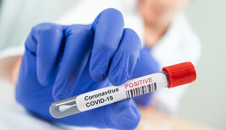 The actual number of Covid-19 cases is much higher than official numbers, recent WHO study reveals stunning facts and data